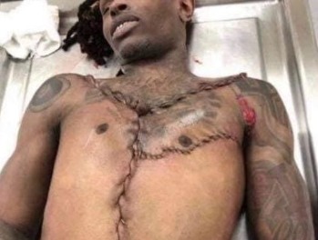 King Von Autopsy